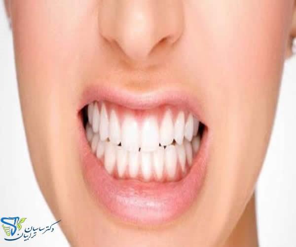 آشنایی با خدمات دندانپزشکی زیبایی و ترمیمی