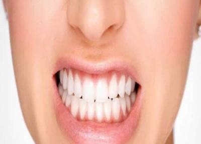 آشنایی با خدمات دندانپزشکی زیبایی و ترمیمی
